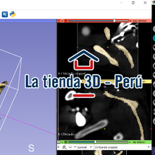 scapula bones bone 3d print model - Mito3D