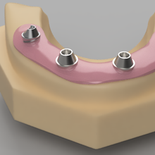 Schraube beibehalten Widerlager Werkzeug Dental Zahnarzt implantieren Niveau Bild Scan dr Zahn Halter 3d print model - Mito3D