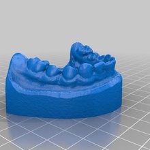 conjunto dientes dental modelo 3d escanear prueba raspi leva Arte escáner exploración anatomía dentista odontología médico escaneos réplicas 3d print model - Mito3D