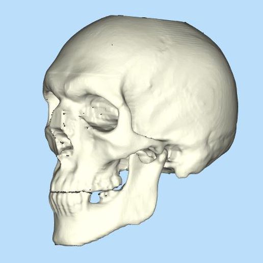 skull  skull cranial flap