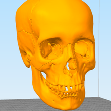 el cráneo varios de la medicina 3d print model - Mito3D