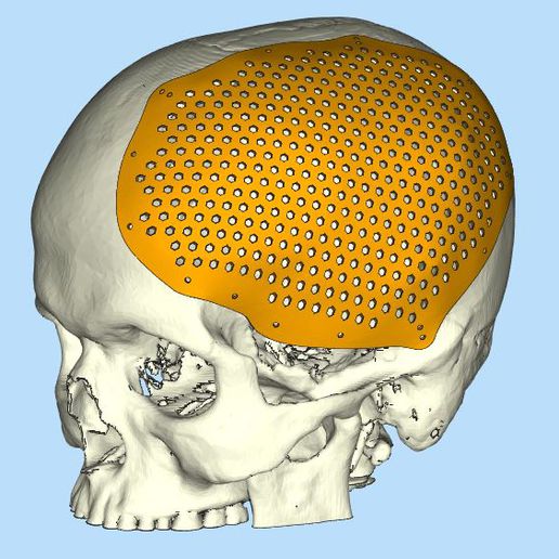 skull cranial flap 1  sku