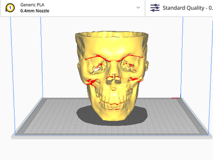 skull mandible cervical spine cranium anatomy medicine complete cranial base 3d print model - Mito3D