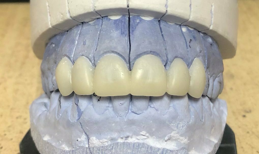 sonreír diseño dientes mordedura llavero 3D print model - Mito3D