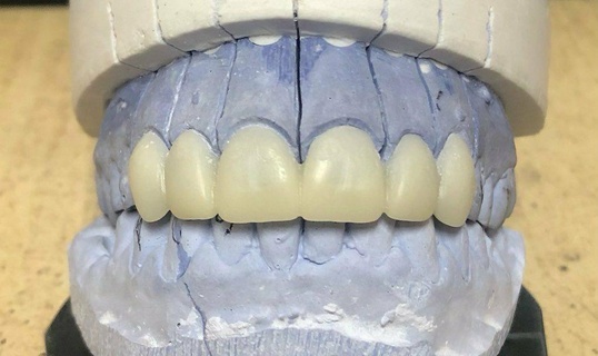 Sorridi design denti mordere portachiavi 3d print model - Mito3D