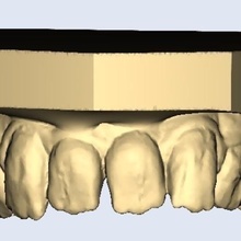 extraño dientes dental modelos dentista bonito modelo arco arcada 3d print model - Mito3D