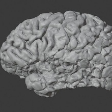 derrame cérebro modelo arte humano anatomia Ciência mri 3d print model - Mito3D