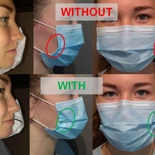 chirurgical masque rétracteur covid19 altylab masques rehablab 3d print model - Mito3D