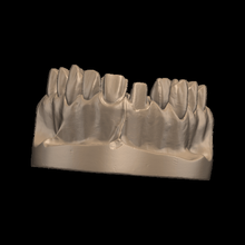 denti vari 3d print model - Mito3D