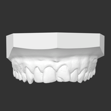 teeth dent dental denti bocca zahn various dentist prosthesis tooth 3d print model - Mito3D
