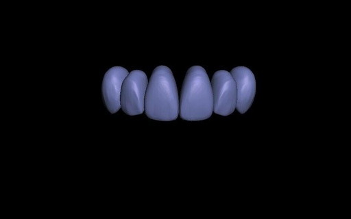 teeth library stl 3d printing orthondotia waxing printed model base top resin enceramento modelo 3d print model - Mito3D