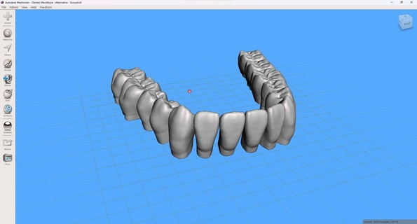 teeth lower jaw - exocad alternative meshmixer 3d print model - Mito3D