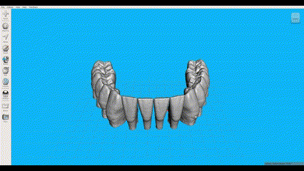 dientes inferior mandíbula exocad robtoly unique mezclador malla 3d print model - Mito3D