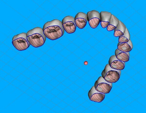 teeth temporary crowns - mandibular-teeth 3D print model - Mito3D
