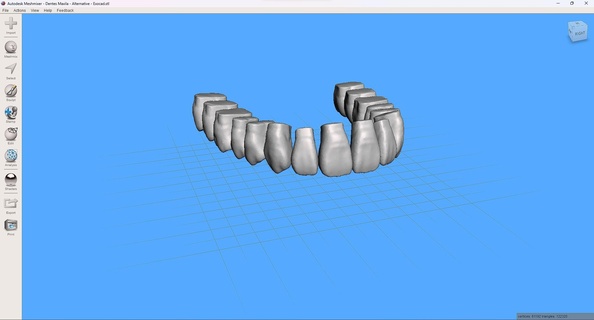 teeth upper jaw - exocad alternative meshmixer 3d print model - Mito3D