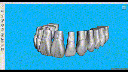 denti superiore mascella exocad robtoly unique meshmixer 3d print model - Mito3D