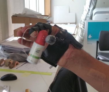 pouce prothèse accessibilité aide assistante technologie assitivetech invalidité poignée main handicap orthèses prothétique outils 3d print model - Mito3D