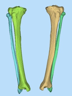 Tibia Fibula Anatomie Gliedmaßen Knochen 3d Drucken 3d print model - Mito3D