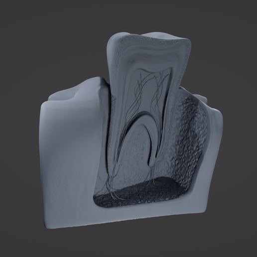 tooth cutaway 3D print model - Mito3D