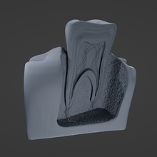 tooth cutaway 3d print model - Mito3D