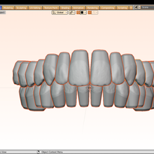 tooth library cl base 3d print model - Mito3D