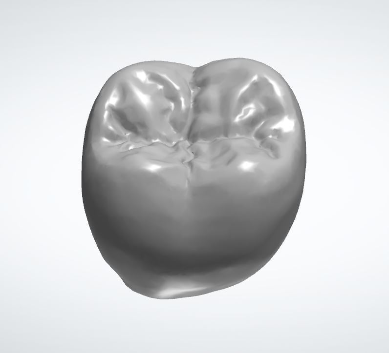 diente morfología 47 prótesis dental 3D print model - Mito3D