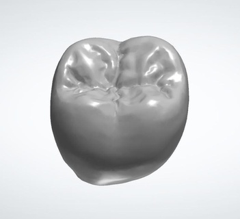 diente morfología 47 prótesis dental 3d print model - Mito3D