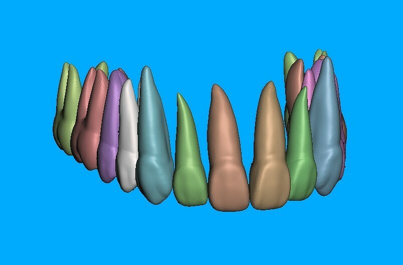 upper jaw - teeth roots meshmixer 3D print model - Mito3D