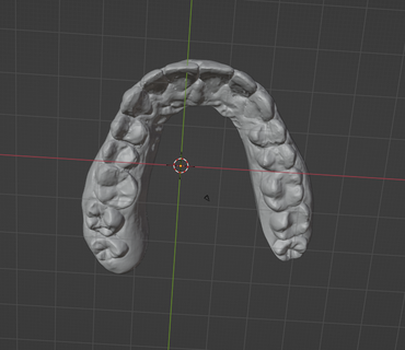 upper jaw dental model Various dental model upper jaw wax up tooth teet dentst exocad  3d print model - Mito3D