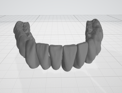 superior mandíbula dentes dental modelo cera up dente exocad 3d print model - Mito3D