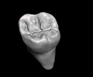 superior esquerda molar dente odontologia prótese 3d print model - Mito3D