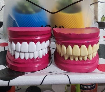 Superior inferior mandíbula dientes dental modelo anatomía odontología medicamento boca escáner 3d print model - Mito3D