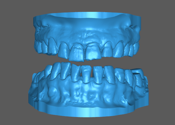 upper lower tooth model dental example 3D print model - Mito3D