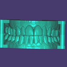upper model support teeth 3d print model - Mito3D