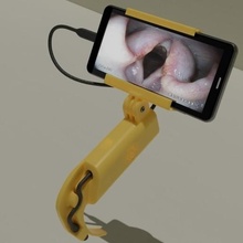 vidéo laryngoscope outil médicament médical endoscopie 3d imprimé lame 3d print model - Mito3D