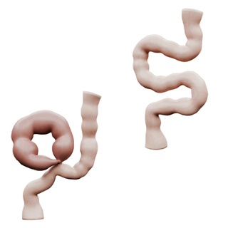 rollo colon estómago anatomía intestino abdominal obstrucción enfermedad abdomen mesenterio digestivo función digestión médico vomitando hinchazón síntoma constipación 3d print model - Mito3D