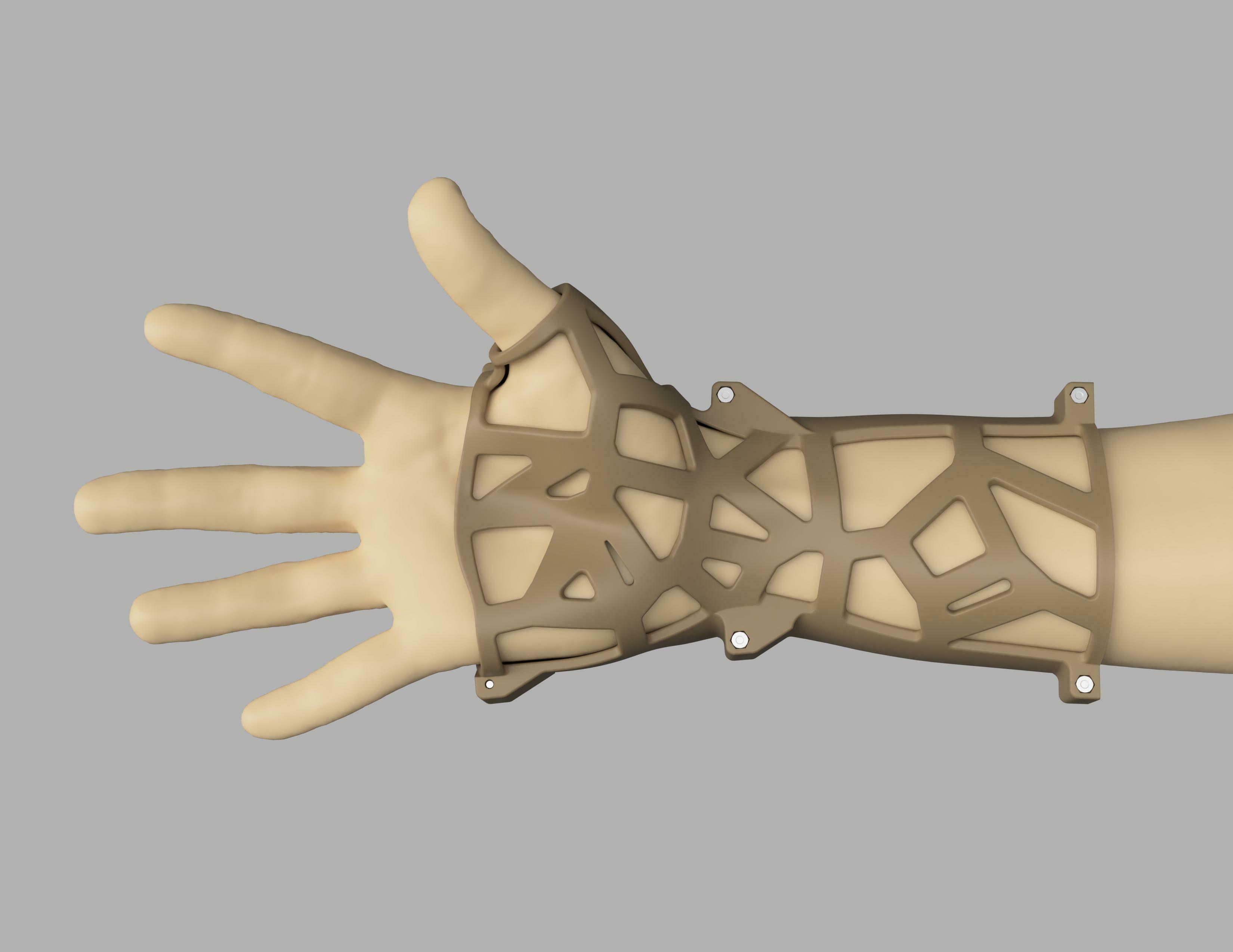 voronoi éclisse orthèse 3D print model - Mito3D