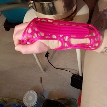 Handgelenk Band medizinisch Armband 3d print model - Mito3D