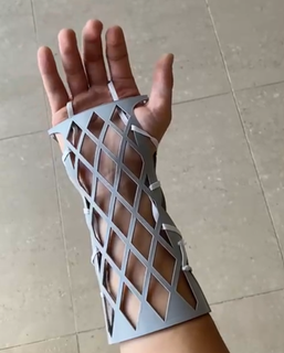 muñeca entablillar inmovilización salud prótesis lesión mano pulsera ortesis Arte frio viral popular descargar cultos fondo pantalla 3d print model - Mito3D