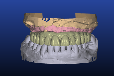 zirconium secondary beam structure model phantom teeth dental art students skills honing technicians 3d print model - Mito3D