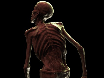 Zombie Kunst Untote Romero Skulptur Grusel Gehhilfe tot beißt Monster Kreatur Skelett Schädel Anatomie Skulpturen Leiche 3d print model - Mito3D