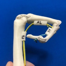 finger flexor tendon anatomy model left bones education hand tendons fds fdp 3d print model - Mito3D