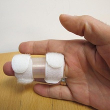 doigt attelles rouleau accessibilité orthèses oignon prothétique 3d print model - Mito3D