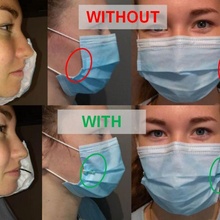 chirurgical masque rétracteur ecarteur mascarade chirurgique covid19 masques chirurgicaux 3d print model - Mito3D