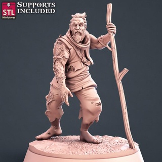 injured villager stl miniatures Tabletop Characters & Creatures Fantasy Universe Store fantasy people wargames tabletop dnd wounded npc 3d print model - Mito3D