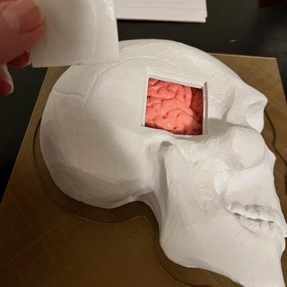 burr hole model maureen nemetski Education University Life Sciences Medical brain ear skull medical simulation craniotomy task trainer education neurosurgery emergency medicine 3d print model - Mito3D