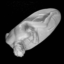 dying gaul scan griego romano escultura 3dscan fotogrametría 3d print model - Mito3D
