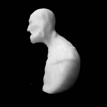 dr eugene koerberle scansione 3d print model - Mito3D
