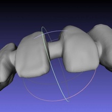 dental bridge dentalbridge 3d print model - Mito3D