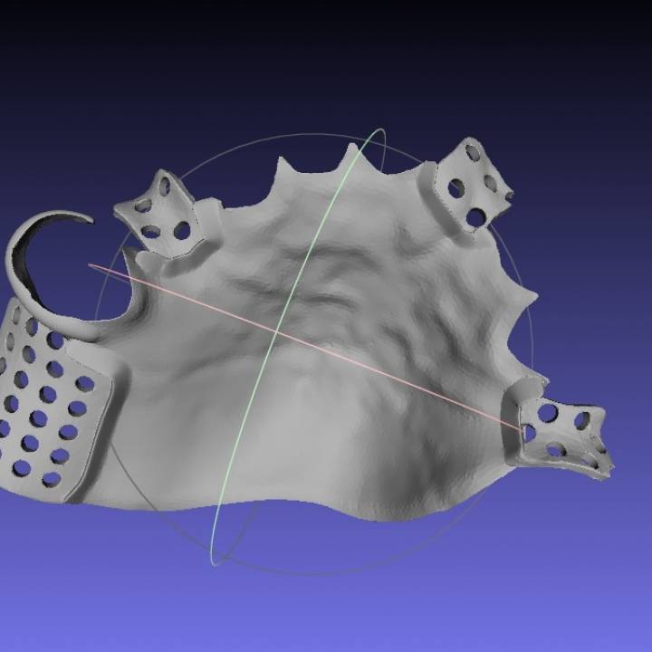 prothèse partielle partialdenture 3D print model - Mito3D
